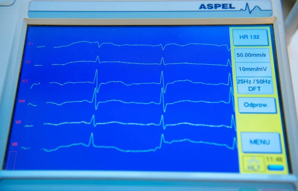 Badanie EKG serca, Fot. PAP/Grzegorz Michałowski