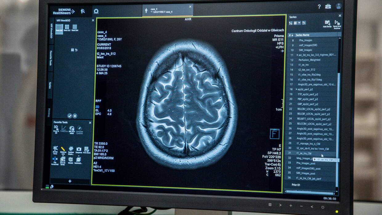 Sztuczna inteligencja, analizująca skany MRI, znalazła nieznane wcześniej różnice w strukturze mózgu kobiet i mężczyzn. Fot. PAP/	Art Service (zdjęcie ilustracyjne)