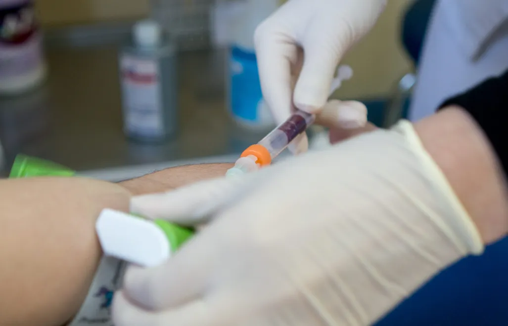 Taka terapia jest jednak stosowana jedynie wtedy, gdy pacjent z HIV zachoruje na chorobę nowotworową. Fot. PAP/	Andrzej Grygiel