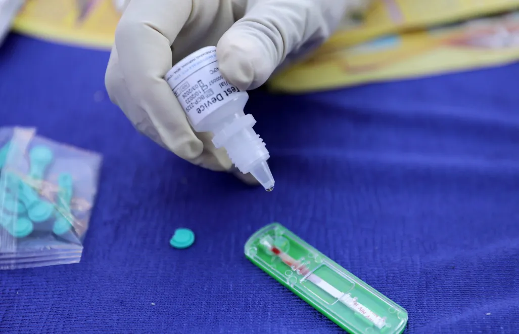 Test na HIV (zdjęcie ilustracyjne). Fot. EPA/PIYAL ADHIKARY