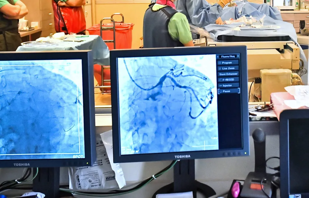 Zabieg laserowy na sercu Fot. PAP/Andrzej Lange