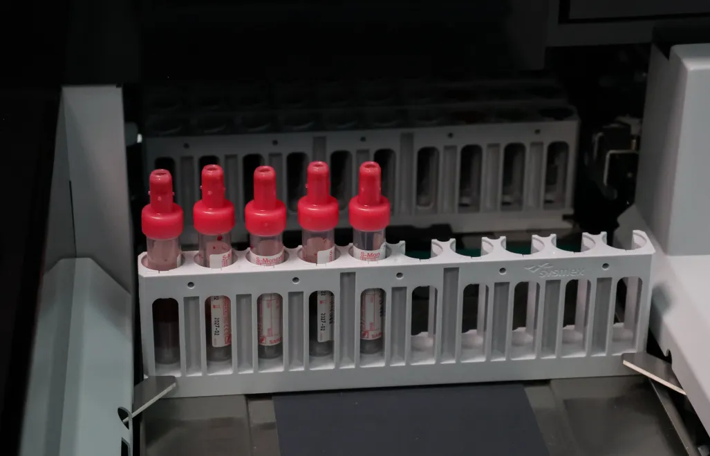 Probówki Fot. PAP/Marian Zubrzycki