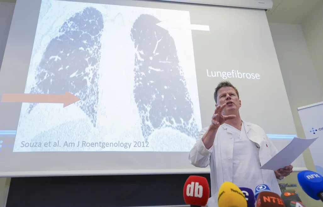 Dr Are Holm opowiada o stanie zdrowia norweskiej księżnej Mette-Marit. Fot. PAP/ EPA/Lise Aserud 