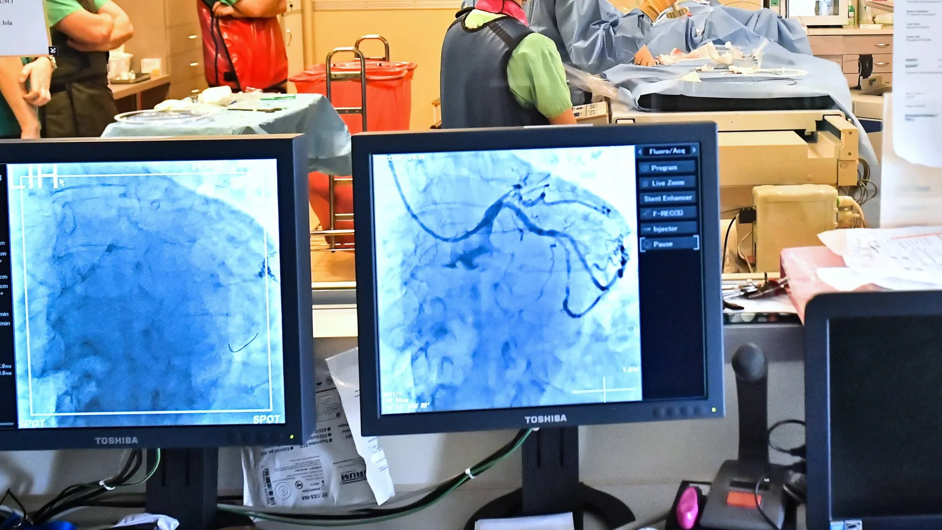 Zabieg laserowy na sercu Fot. PAP/Andrzej Lange