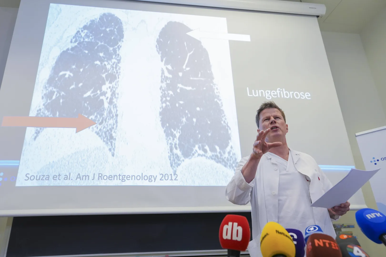 Dr Are Holm opowiada o stanie zdrowia norweskiej księżnej Mette-Marit. Fot. PAP/ EPA/Lise Aserud 