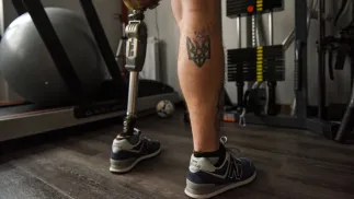 26-letni żołnierz Pułku "Azow" Vitalii, który stracił jedną nogę w walce, przebywa w centrum rehabilitacyjnym w Kijowie, Fot. PAP/EPA/OLEG PETRASYUK