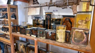 Eksponaty w Muzeum Medycyny Sądowej Uniwersytetu Medycznego we Wrocławiu. Fot. PAP/Maciej Kulczyński