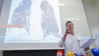 Dr Are Holm opowiada o stanie zdrowia norweskiej księżnej Mette-Marit. Fot. PAP/ EPA/Lise Aserud 