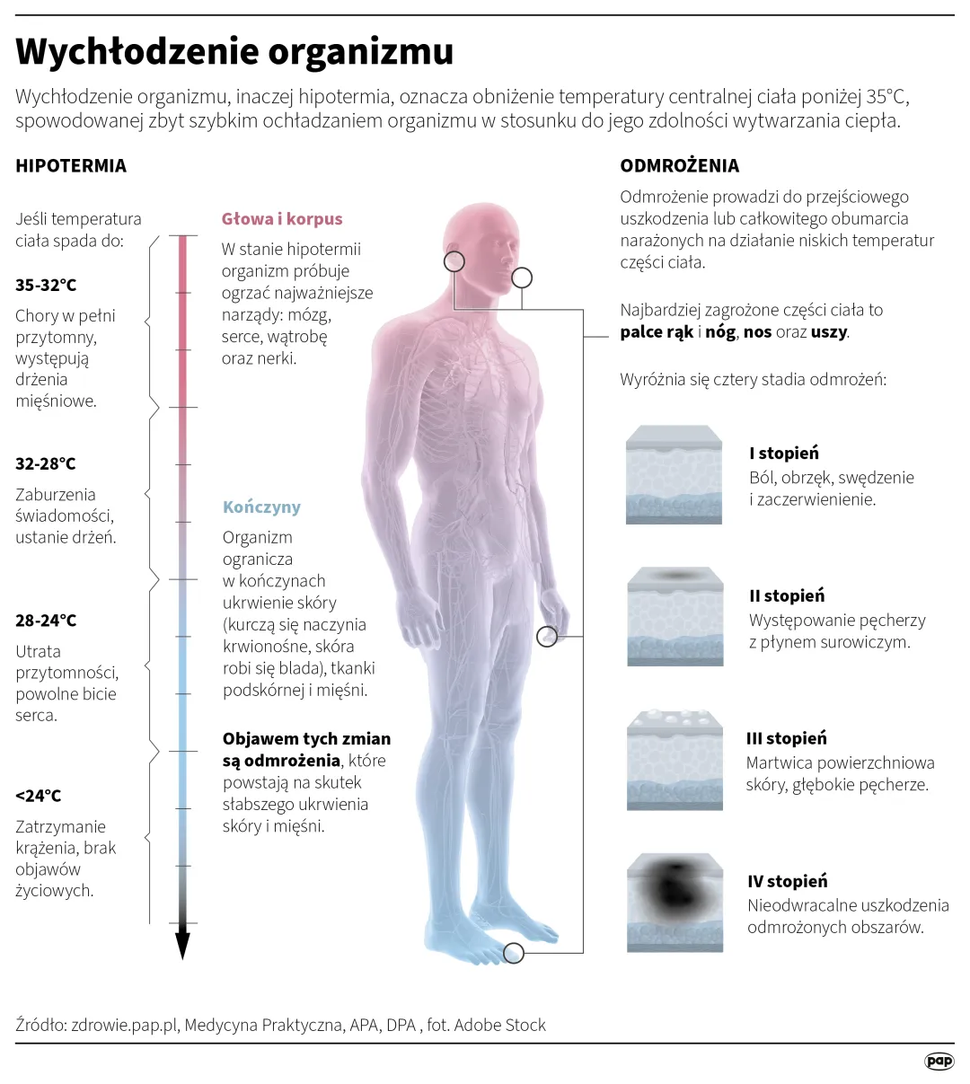 Wychłodzenie organizmu. Autor: PAP/Infografika/Mateusz Krymski