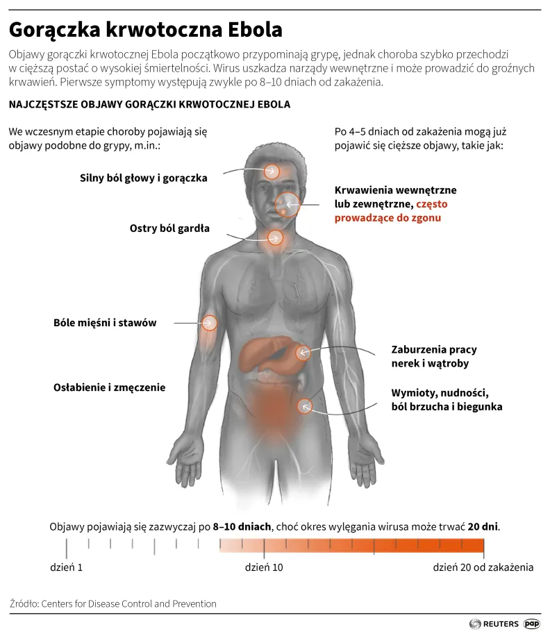 Gorączka krwotoczna Ebola, autor: Mateusz Krymski