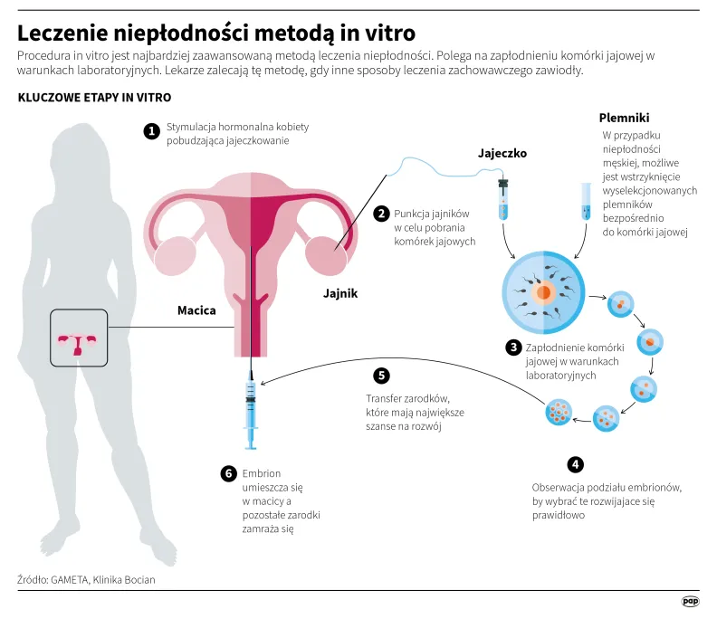 Leczenie niepłodności metodą in vitro. Autor: Adam Ziemienowicz
