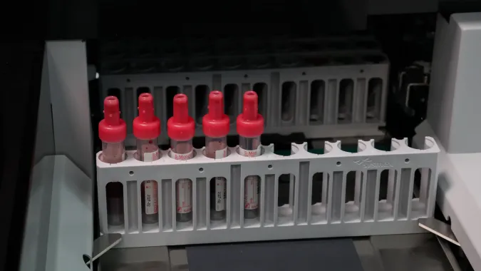 Probówki Fot. PAP/Marian Zubrzycki