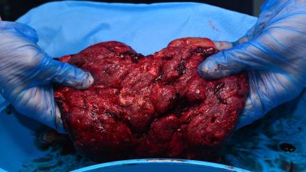 Łożysko Fot. PAP/Newscom