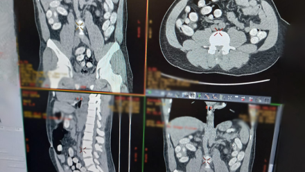 Prześwietlenie przemytnika. Źródło: Krajowa Administracja Skarbowa/Izba Administracji Skarbowej w Warszawie