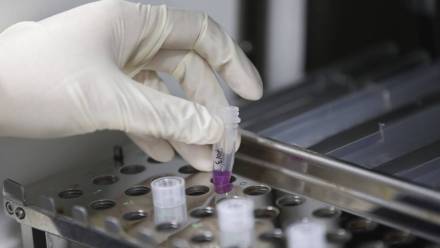 Prace laboratoryjne nad lekiem przeciwko małpiej ospie. Zdjęcie ilustracyjne. Fot. PAP/EPA/RUNGROJ YONGRIT